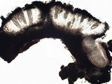 Phlyctis agelaea image