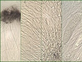 Phlyctis agelaea image