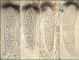 Phlyctis agelaea image