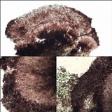 Lecidea sarcogynoides image
