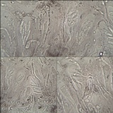 Lecidea sarcogynoides image