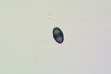 Rinodina bischoffii image