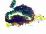 Cyphelium karelicum image