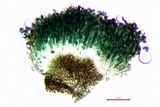 Cyphelium karelicum image