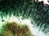 Cyphelium karelicum image
