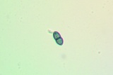 Cyphelium karelicum image