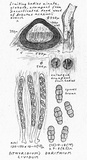 Dyrithium lividum image