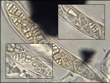 Hysterobrevium smilacis image