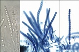 Trichoderma citrinoviride image