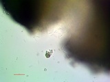 Lecidea tessellata image