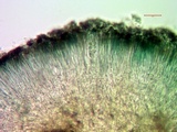 Lecidea tessellata image
