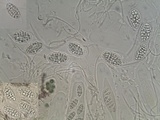 Julella vitrispora image