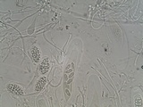 Julella vitrispora image