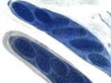 Julella vitrispora image