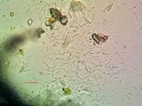 Aspicilia caesiocinerea image