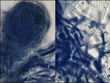 Gibberella zeae image