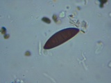 Xylaria polymorpha image