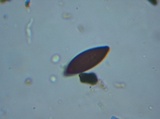 Xylaria polymorpha image