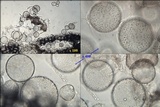 Coprinopsis tuberosa image