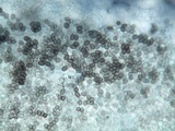 Coprinopsis tuberosa image