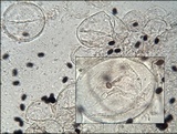 Coprinopsis foetidella image