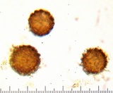 Scleroderma areolatum image