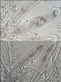 Pertusaria heterochroa image