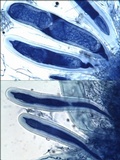 Pertusaria heterochroa image