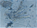 Hysterium pulicare image