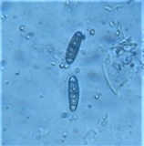 Hysterium pulicare image