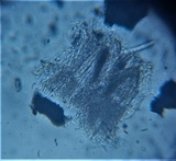Hysterium pulicare image