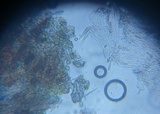 Cryptodiscus rhopaloides image