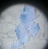 Cryptodiscus rhopaloides image