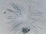 Trichoderma citrinoviride image