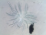 Trichoderma citrinoviride image