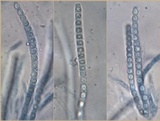 Trichoderma citrinoviride image