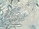Hysterobrevium smilacis image