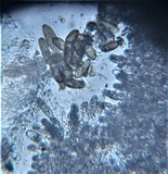 Sphaeropsis sapinea image