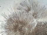 Cheilymenia granulata image