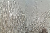 Cheilymenia granulata image