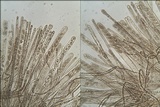 Cheilymenia granulata image