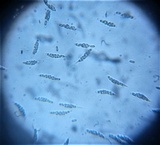 Natantiella ligneola image