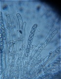 Tarzetta cupularis image