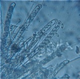 Tarzetta cupularis image