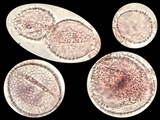 Coprinopsis foetidella image