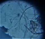 Glyphium elatum image
