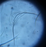 Glyphium elatum image
