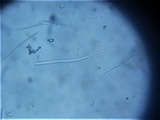 Glyphium elatum image