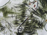 Hypomyces papulasporae image