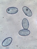 Cheilymenia granulata image